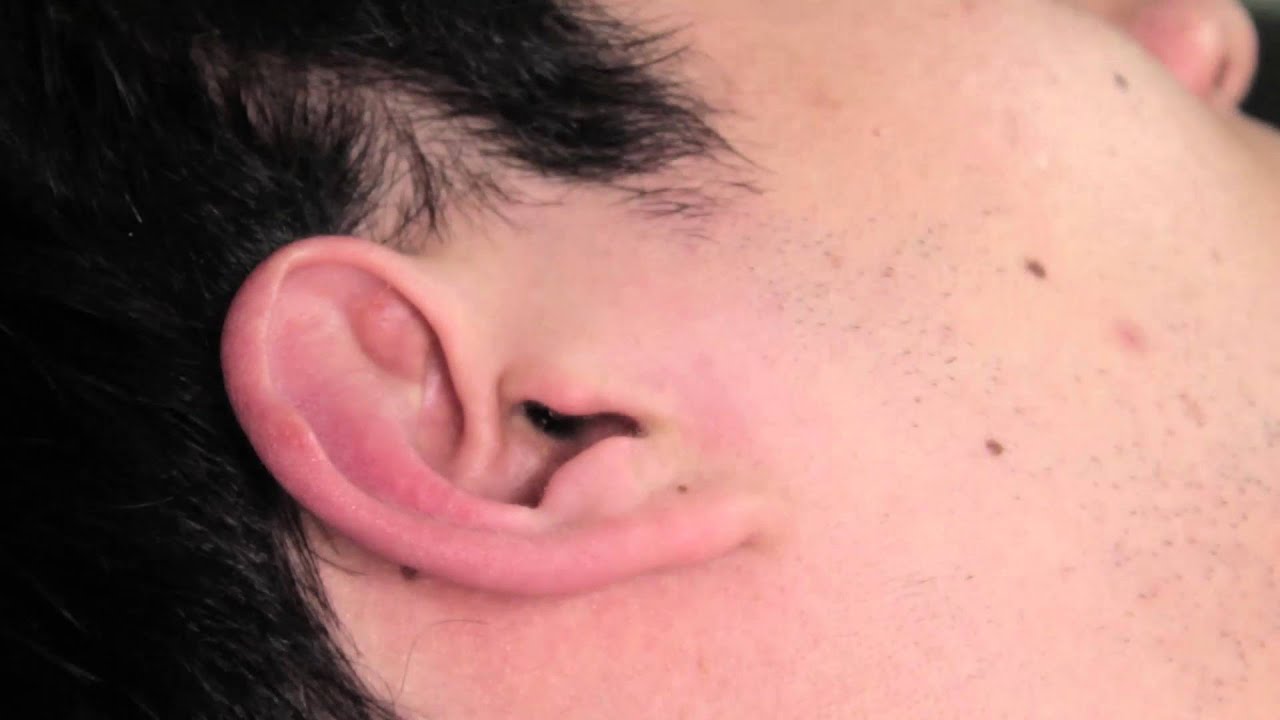 ear cleaning, ear picking, 耳かき, 귀청소, ear wax YouTube