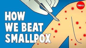 How we conquered the deadly smallpox virus - Simona Zompi