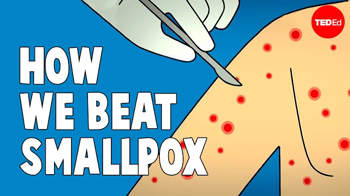 How we conquered the deadly smallpox virus - Simona Zompi - DayDayNews