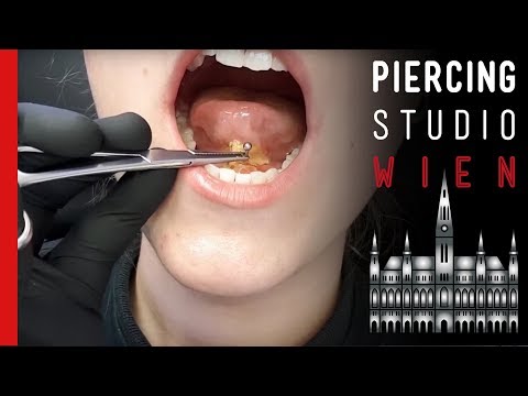 Video: Piercing - Schaden, Arten, Verfahren