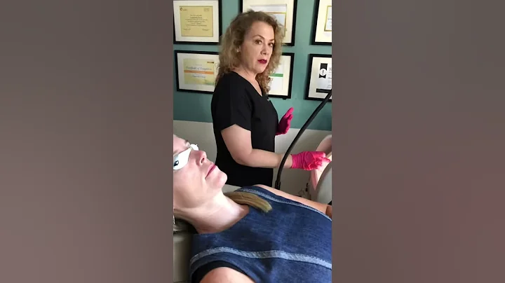 Vbeam Broken Blood Vessels  | Part 1