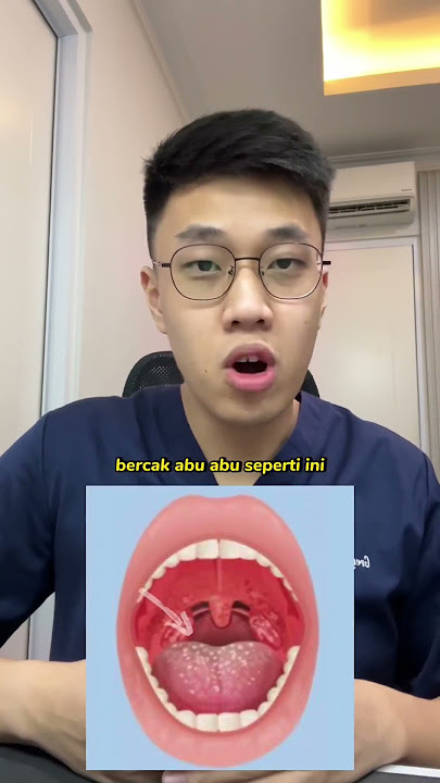 Aku yakin pasti sering deh kalian kena radang tenggorokan. Nih aku kasih tau tips buat radang 🤩