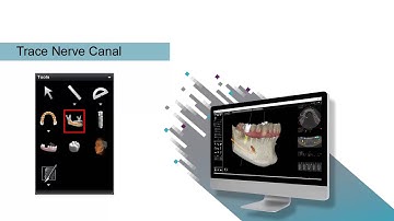 CS 3D Imaging: Utilizing the 3D Tools to Analyze 3D Volumes