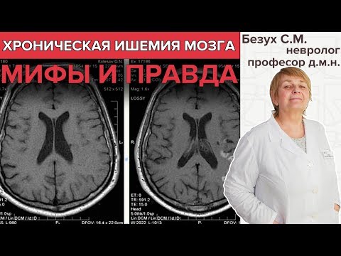 ХРОНИЧЕСКАЯ ИШЕМИЯ МОЗГА