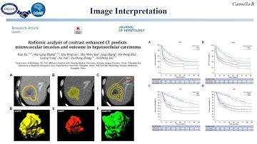 W66 AI in Abdominal Radiology – EuSoMII  ESGAR Joint Session by R. Cannella and A. Pecchi