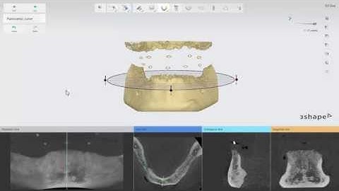 Implant Studio - 2.Edentulous case. How to prepare the CBCT data