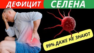 ТРЕВОГА Признаки Дефицита СЕЛЕНА в организме! 99% даже не знают об этом