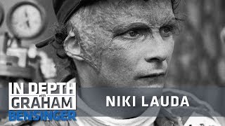 Niki Lauda after his skin grafting operation following his crash