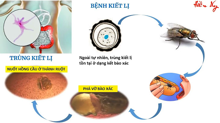 Thức ăn của trùng kiết lị là gì năm 2024