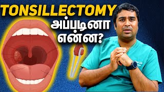 Understanding Tonsillectomy with Dr. Vignesh Gokul | Expert ENT Explains in Tamil