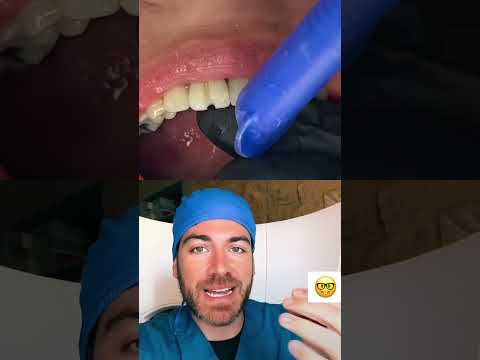Vídeo: El dentista et blanqueja les dents?