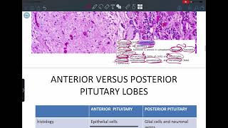 Endocrine pathology lecture 1 (pituitary gland )