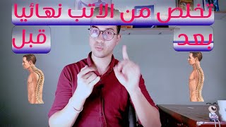 تخلص من تقوس الضهر 