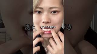 みんなも定期検診行きな〜^_^ ※TikTok過去動画転載