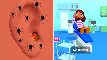 Earwax Clinic in Max Level iOS,Android Gameplay Walkthrough All Trailers Update Game Mobile LKVOIEUA