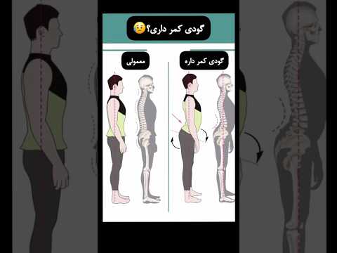 بجز گودی کمر چیو بزارم هر حرکت ۲ تا ۳ دقیقه در روز اجرا کنید