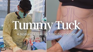 Amazing Natural Looking Tummy Tuck + BBL! | Barrett