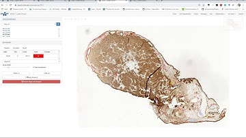 EXACT: Dataset types (de)