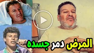 الفنان الجزائري حكيم الكاهنة المرض اجبره على اعتزال الفن وغير ملامحه وكان سيموت بسبب العمليات .