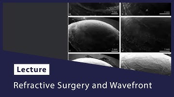 Refractive Surgery and Wavefront