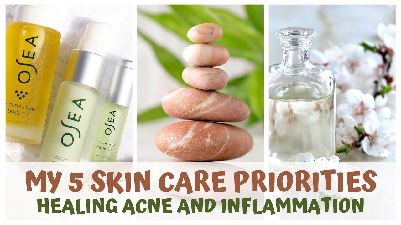 MY TOP 5 SKIN CARE PRIORITIES • RAW FOOD VEGAN & ACNE HEALING