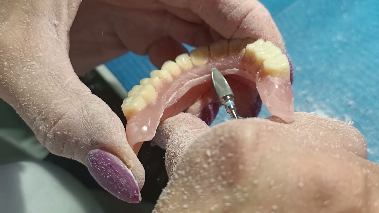 Wymiana podniebienia w protezie akrylowej i podścielenie