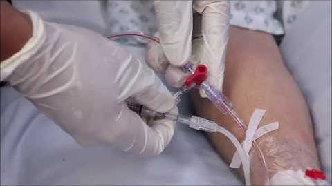 LiDCO Calibration Guide - How to set up the disposables