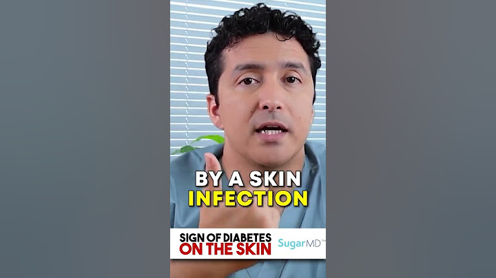 Dry Itchy Skin  | Sign of Diabetes on The Skin