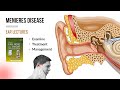 Meinere's Disease Complete lecture||ENT lectures|| Dhingra ENT #ear #dhingra #ent