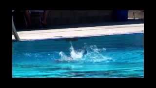 Brachial Plexus & Synchronized Swimming