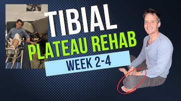 Tibial Plateau Injury Rehab Exercises  Weeks 2 through 6 Post-Surgery