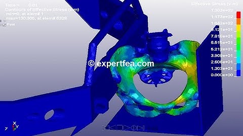 LS-DYNA FINITE ELEMENT ANALYSIS - Car bumper impacting hip on 2 directions at 36 km/h