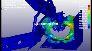 LS-DYNA FINITE ELEMENT ANALYSIS - Car bumper impacting hip on 2 directions at 36 km/h Net Worth