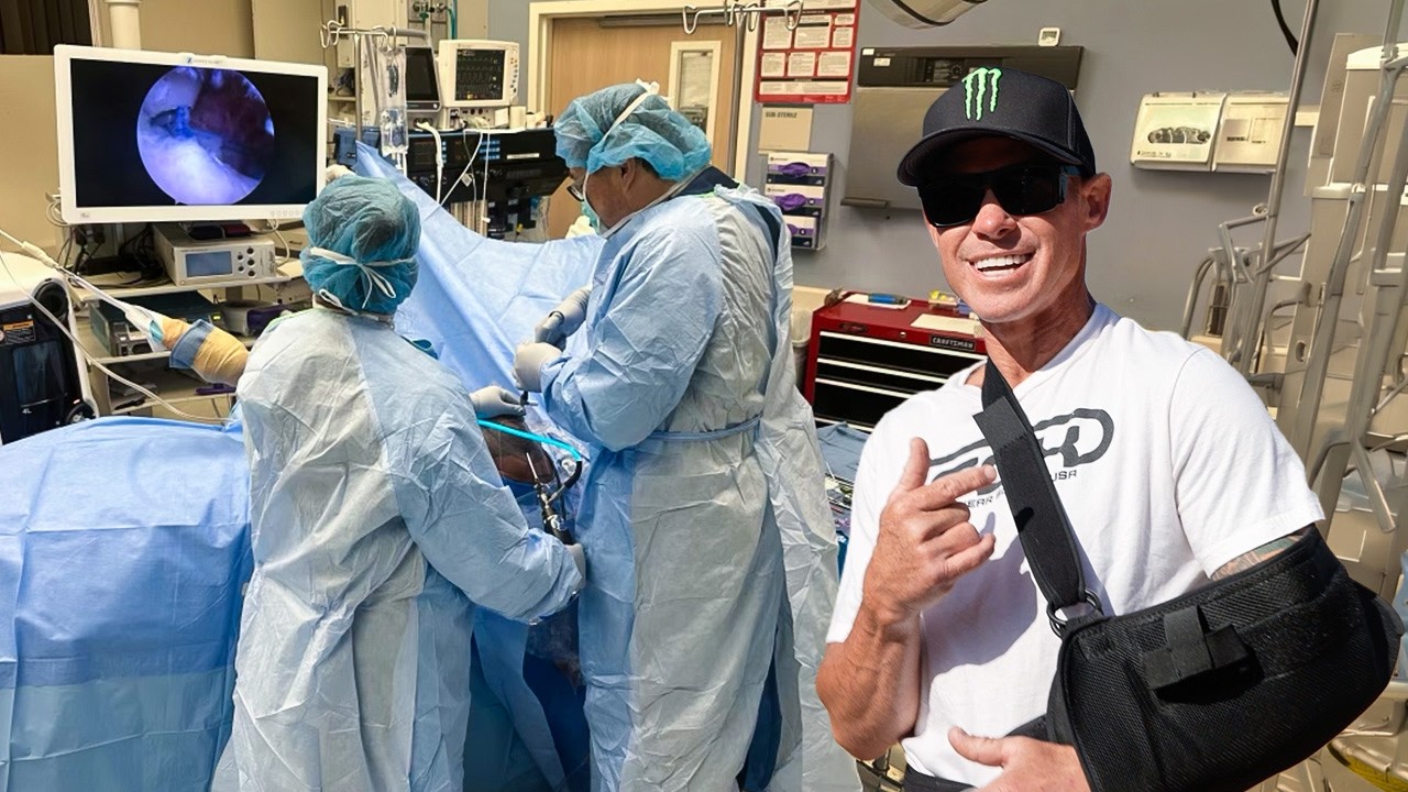 Bad Crash | Had To Get Surgery