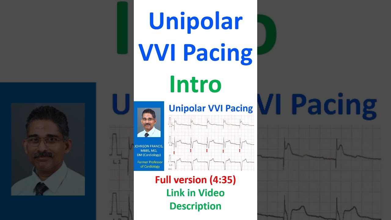 Unipolar VVI Pacing