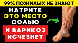 Варикоз исчезнет, если делать это!!! 99% пенсионеров не знают: соль лечит вены лучше таблеток