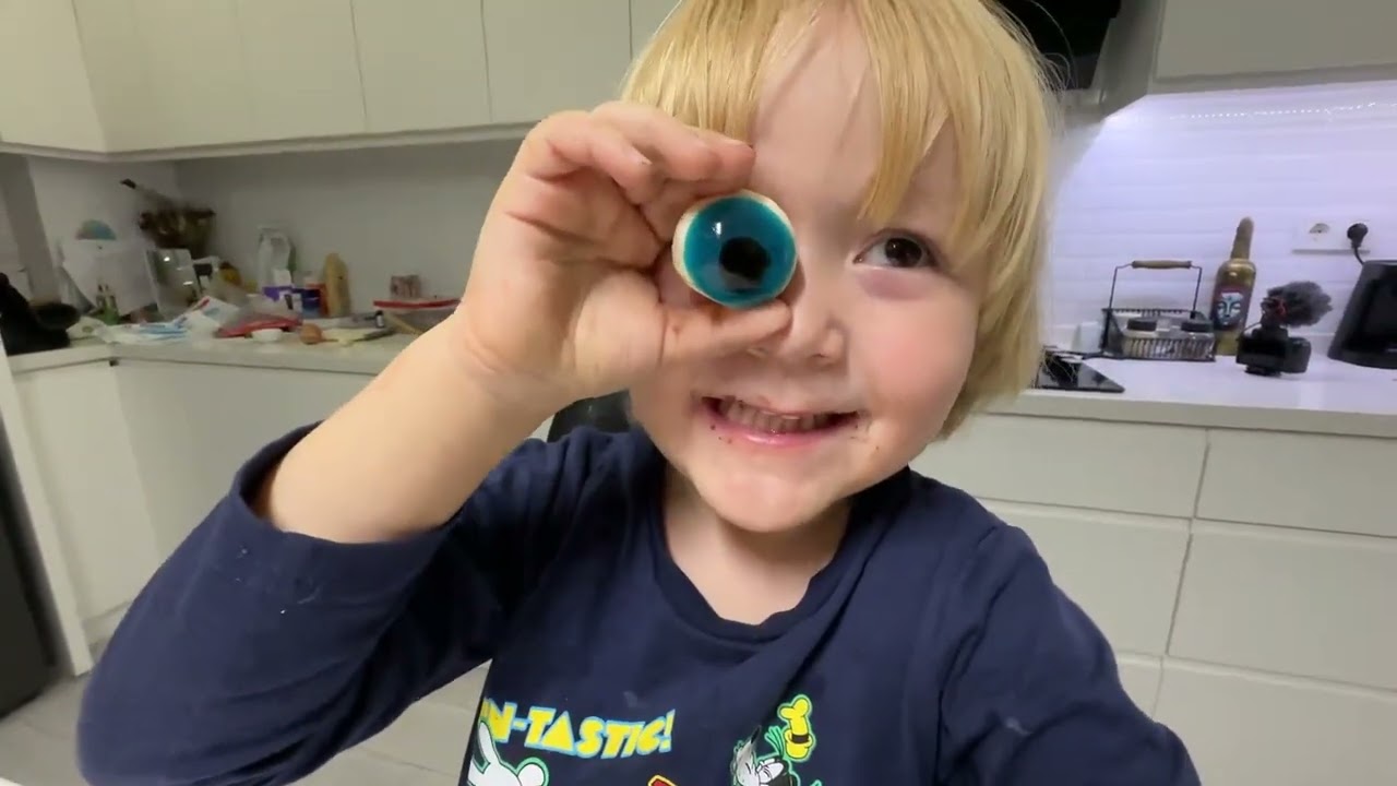 KARDEŞİMİN GÖZÜNE NE OLDU ??