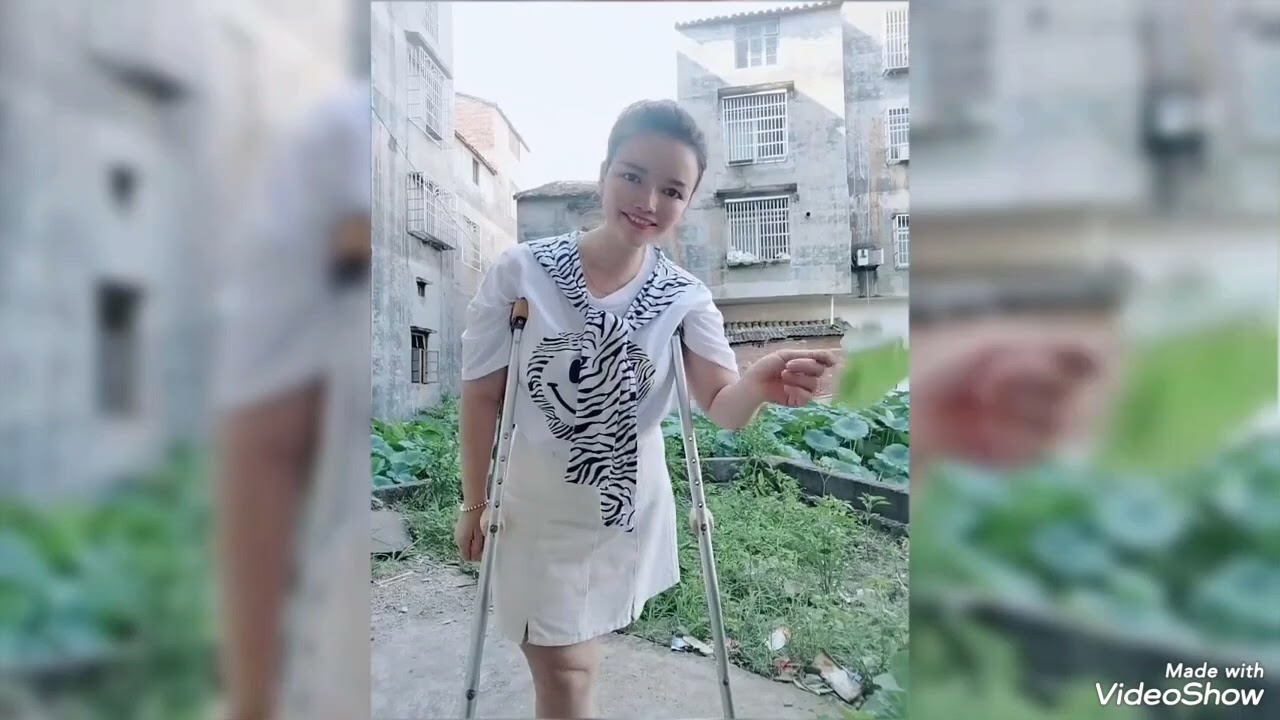 Beautiful woman with one leg amputated and walking with crutches and one leg #amputee 