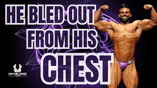 Tragic Peptide Mistake: Bodybuilder Bostin Loyd's Kidney Failure