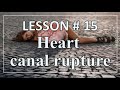 #QIGONG LESSON # 15 Heart canal rupture