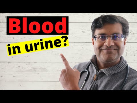 Blood in the urine, what does it mean? (Hematuria): Doctor examines 10 causes!