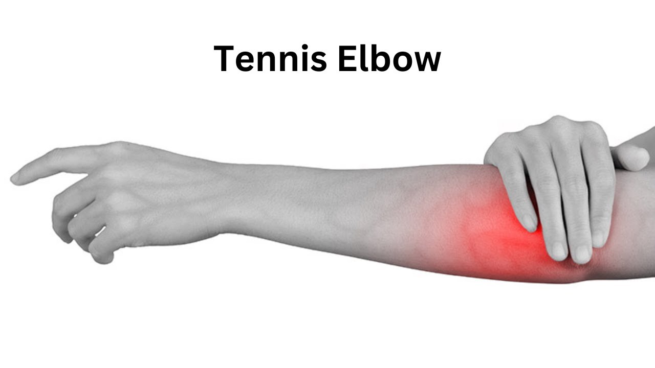 What is Tennis Elbow? Know about causes and treatment of Tennis Elbow. YouTube