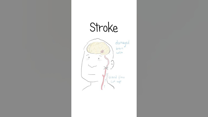 Strokes Explained #healthsketch #shorts
