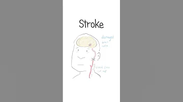 Strokes Explained Healthsketch Shorts 