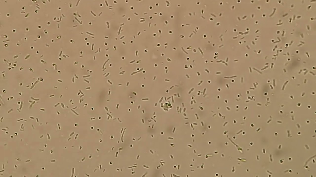 Stenotrophomonas maltophilia Wet mount of Tryptone soy broth Microscopy after 3 days of incubation