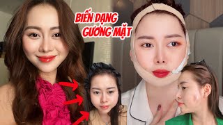 Việt Phương Thoa Bị Biến Dạng Gương Mặt Sau 6 Năm PTTM