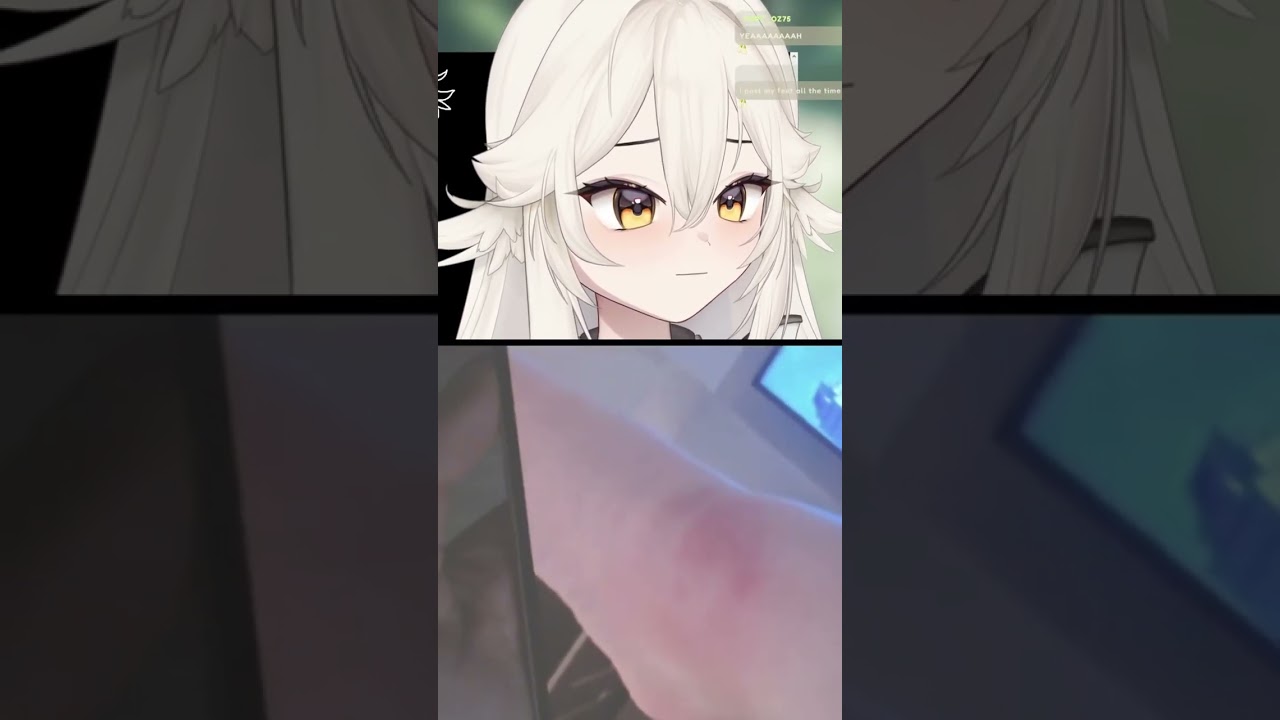 Leg Rot Vtuber Has Leg Rot Again 