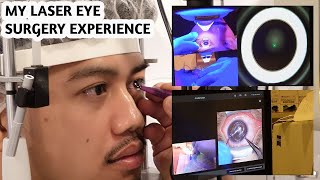 My Laser Eye Surgery Experience!!! (Salt Papi’s VLOG)