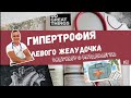 ГИПЕРТРОФИЯ ЛЕВОГО ЖЕЛУДОЧКА (LVH)