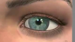 Диабетическая ретинопатия сетчатки глаза:   причины, симптомы и лечение